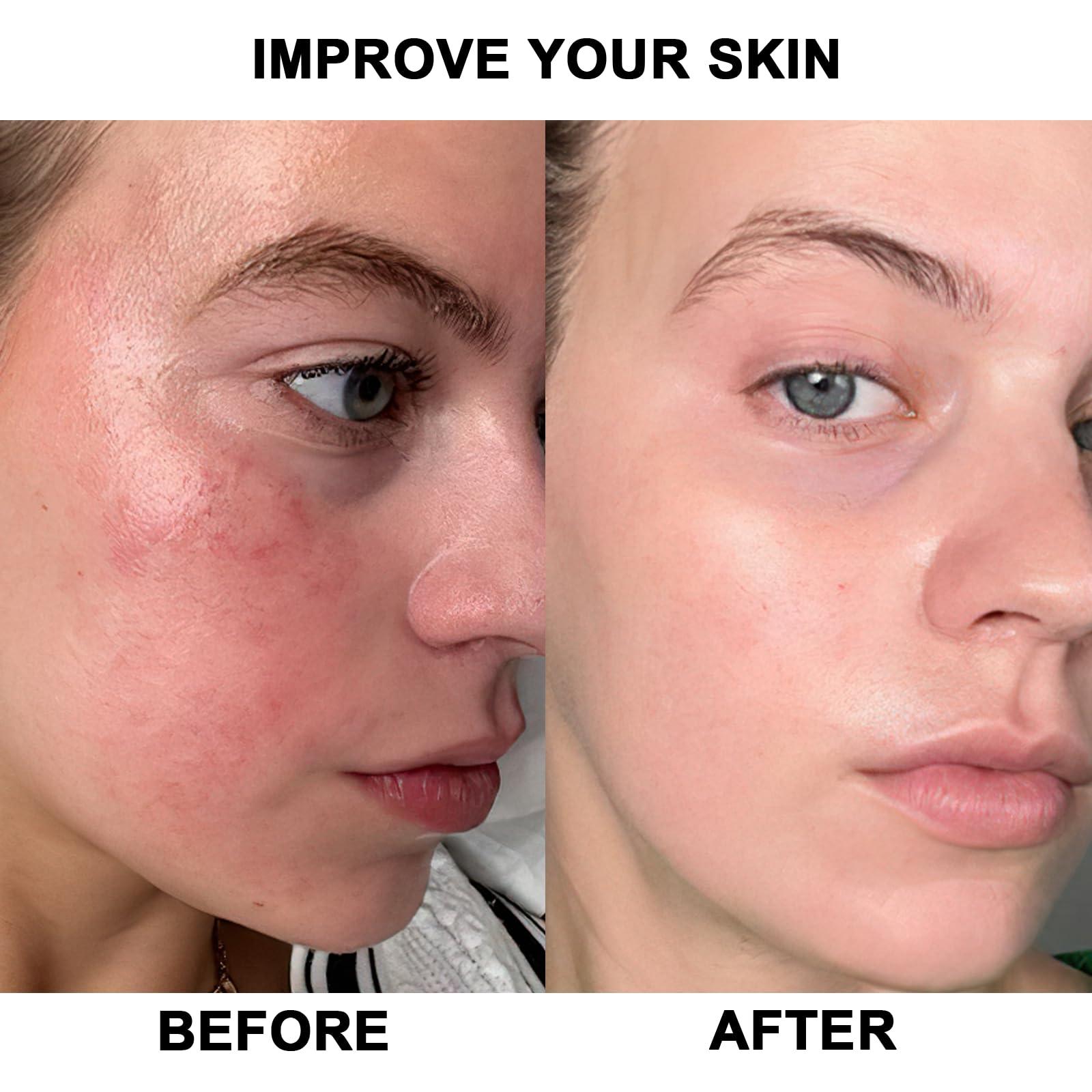 Anyork Red Light Devices for Face Full Body Red Light Lamp High Power Infrared Light Panel for Skin Health 660nm