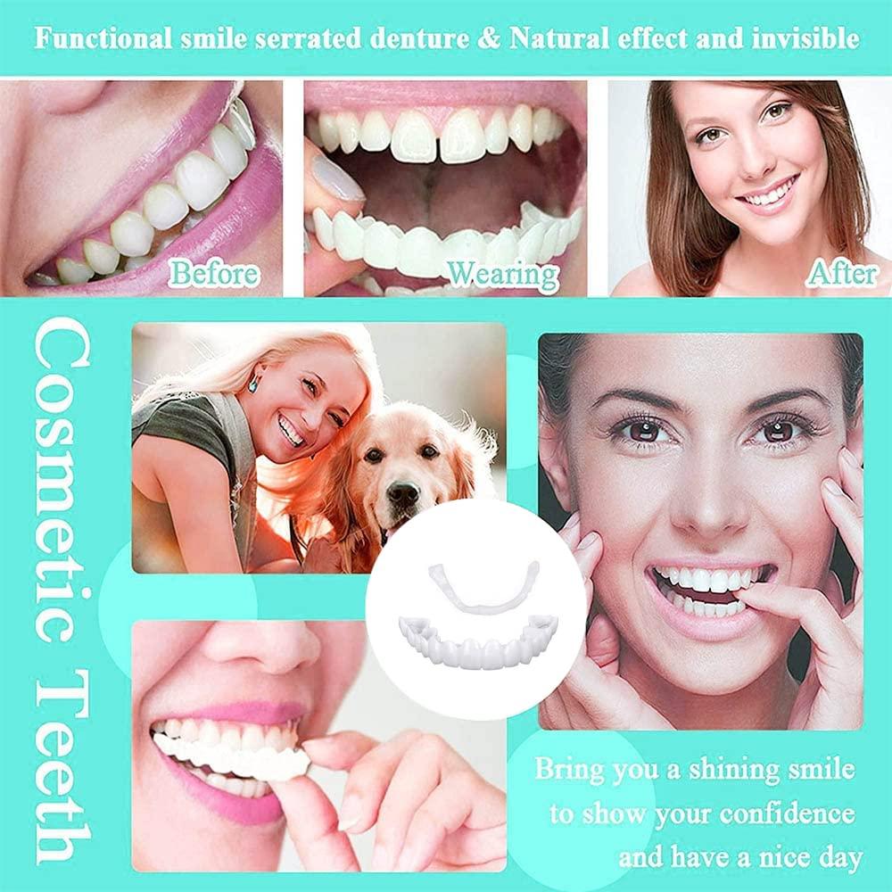 SHxxyljh 1Set Dentures Veneers Tooth,Dental Care Kits for Anti Molar Orthodontic Cosmetic Teeth,Smile Snap Tooth.(White,1Top+ 1Bottom+2Adhesives+1Tweezers+1Heart-Shaped Storage Box