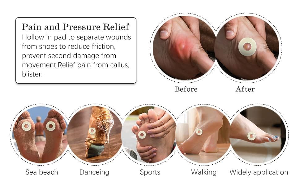 MYMULIKE Corn Pads for Toes Soft Foam Callus Cushions Corn Cushion Pads Self Stick Adhesive Foot Care Cushions Waterproof Corn Protectors for Feet Women Men