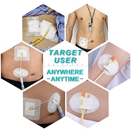 DiaBelt Peritoneal Dialysis PD Catheter Drain Split Bordered Gauze Island Dressing Pad for Stomach Feeding Peg J Tube| Individually Packed| Wound Bandage with Adhesive Border 4\" x 4\" (Pack of 10)