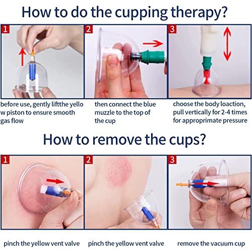 carezoe Cupping Therapy Set, 24Pcs Professional Chinese Acupoint Massage Therapy Cups with Vacuum Pump/Removable Magnetic Column, Hijama Physical Biomagnetic Cupping Kit (Standard 24Pcs)