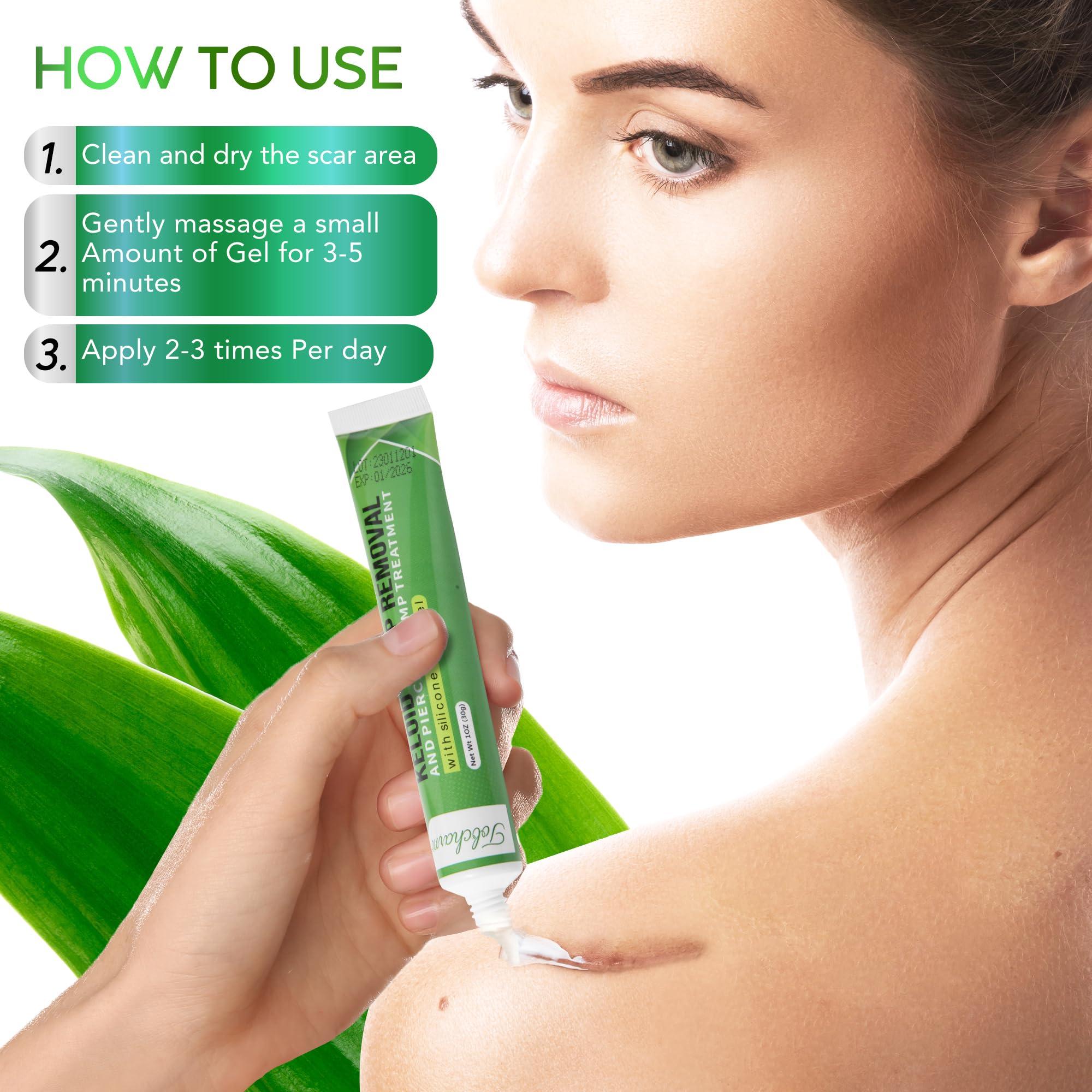 Tobcharm Advanced Keloid Bump Removal Gel: Silicone Keloid Scar Removal Cream for Scars from Piercing, Surgical Marks, Acne, and Burns, Keloid Treatment for Ears, Face, and Body with Healing Formula 30g