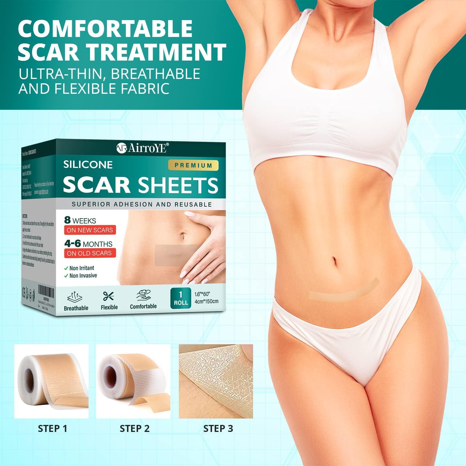 AirroYE Silicone Scar Sheets,Silicone Scar Tape(1.6\"x 60\" Roll-1.5M), Reusable And Effective Scar Removal Sheets, Silicone Scar Removal Sheets For Surgical Scars,Healing Keloid, C-Section, Tummy Tuck