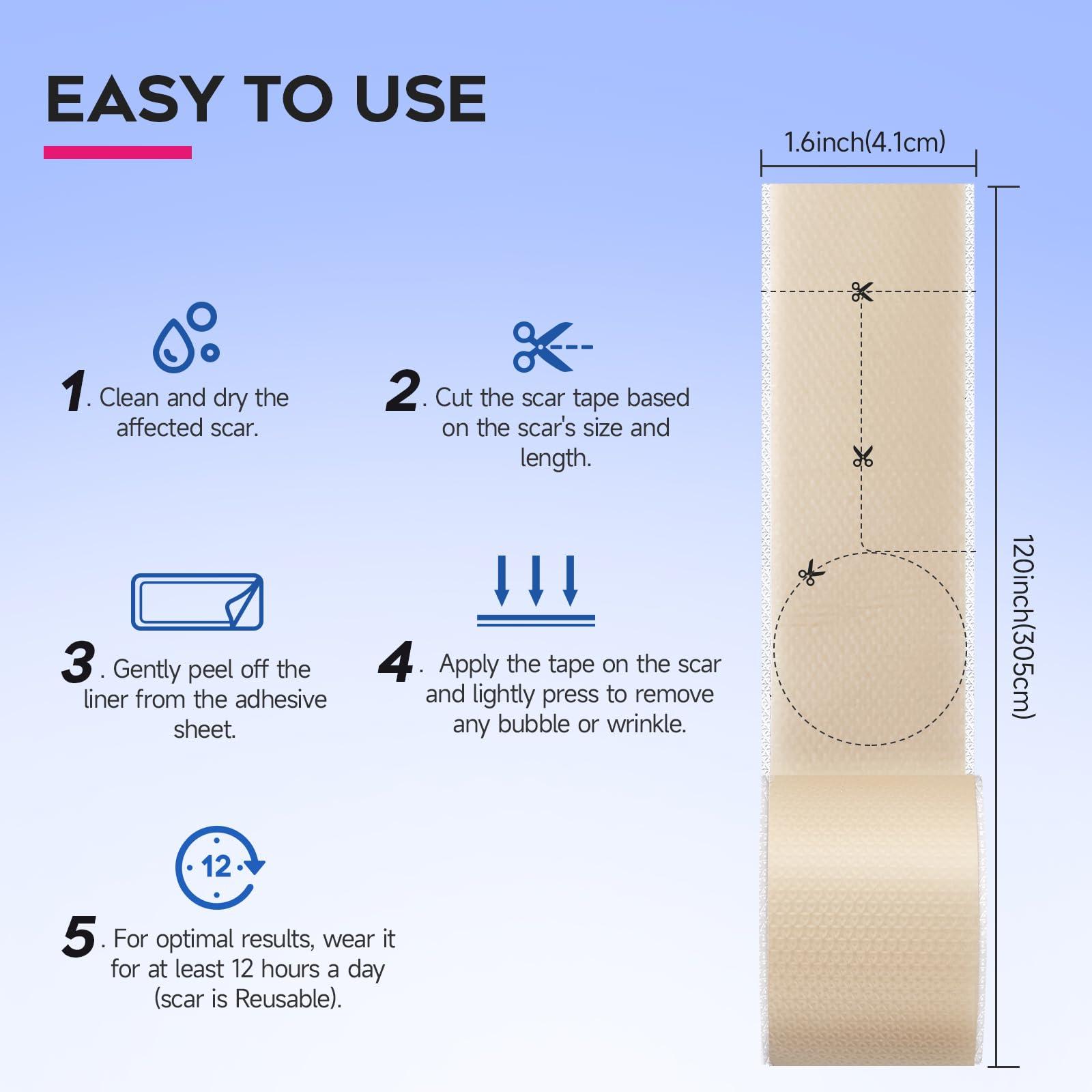 EzonaCare EzonaCare Thicker Silicone Scar Sheets, Medical Grade Silicone Scar Tape Roll (118\" x 16\") Effective, Strong Stickiness, Scar Sheets for Surgical Scars, Keloid, C-Section, Burn, Acne