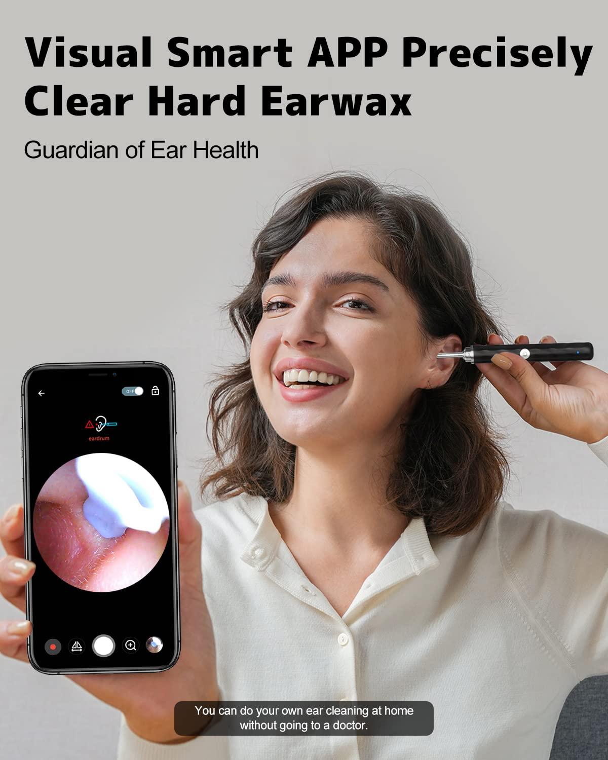 Right Ear Wax Removal, Ear Cleaner with Camera and Light, Ear Wax Removal Kit with 1296P Otoscope, Ear Cleaning Tool with 6 Ear Spoon, Ear Camera for iPhone & Android Phones,Black