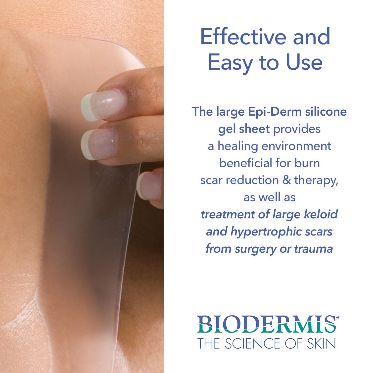 BIODERMIS Epi-Derm Large Sheets, Premium Grade Silicone Scar Sheets for C-Section, Tummy Tuck, Hysterectomy & Cardiac Surgery Scars, Easy To Use & Reusable Silicone Gel Sheets for Scars, 11 x 15.75 in - Natural