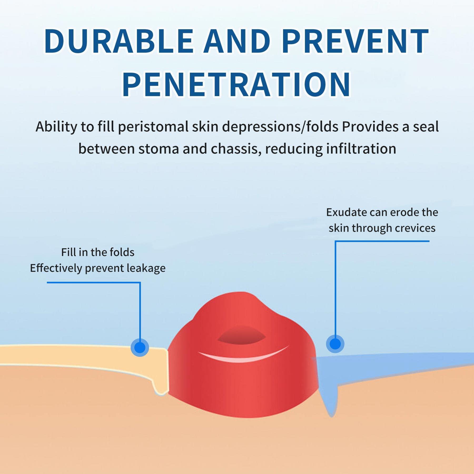 ovand Ostomy Barrier Rings - Ostomy Supplies - 2 mm Thickness Moldable Ostomy Rings Medical Grade Hydrocolloid Adhesive Barrier Rings Better Seal for Ostomy Bags (Box of 10)