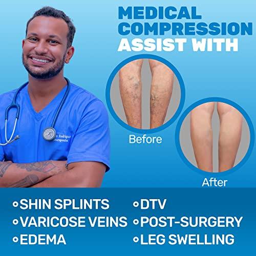 ABSOLUTE SUPPORT Absolute Support Wide Calf Mens Compression Stockings 20-30mmHg - Plus Size Opaque Thigh Hi Compression Socks for Men Circulation, Varicose Veins, Swelling, Lymphedema, Knee Surgery - Black, 3X-Large