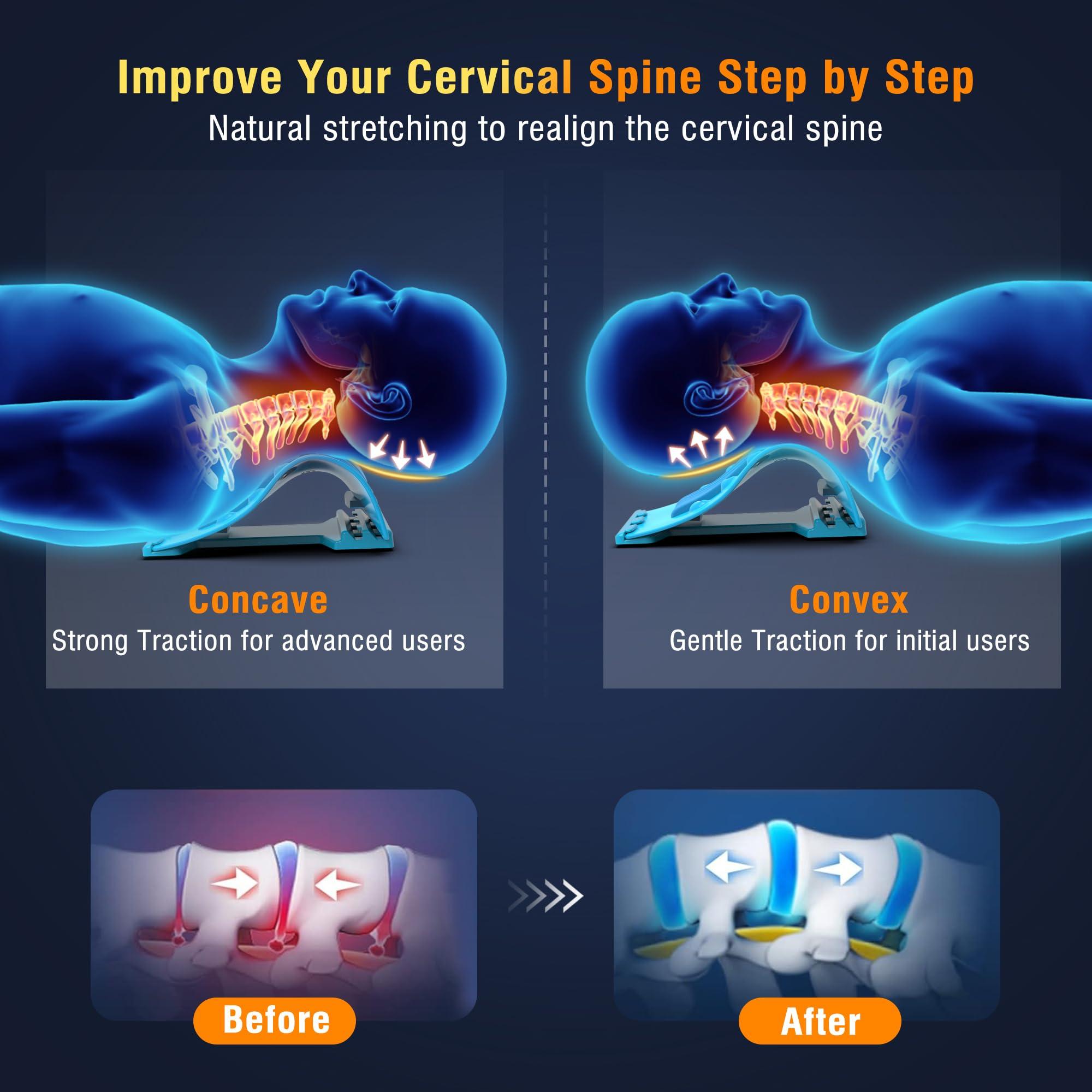 TEMASH TEMASH Cervical Traction Device - Heated Neck Stretcher for Instant Neck Pain Relief, Tension Headache Reduction, and TMJ Pain Relief, with Cervical Spine Pillow to Correct Neck Hump(Blue)