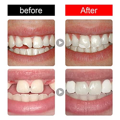 Ceonam 56 Pcs False Teeth Dental Complete Acrylic Resin Denture Teeth, 2 Set Whole Teeth Synthetic Polymer Denture Tooth, 23 Shade A3 Upper + Lower Dental Materials for Replacement, DIY, or Halloween