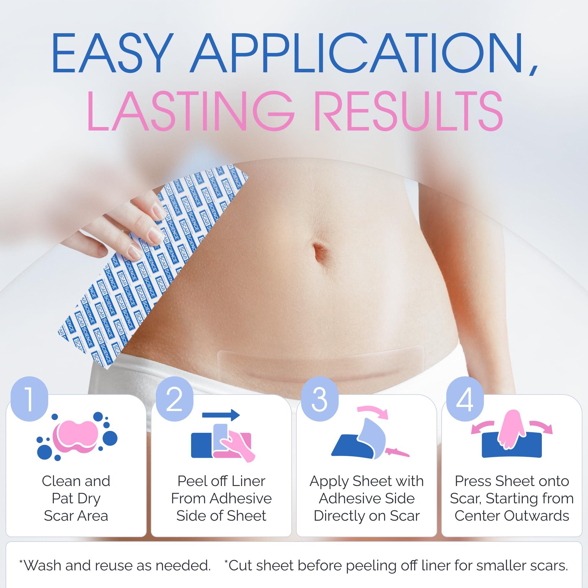 ScarScience ScarScience C-Section Recovery Kit - Advanced Scar Treatment after C-Section - Medical Grade Waterproof Silicone Scar Sheets for Scar Removal, 8 Strips + Silicone Gel for Scars and Surgical Scars,18ml