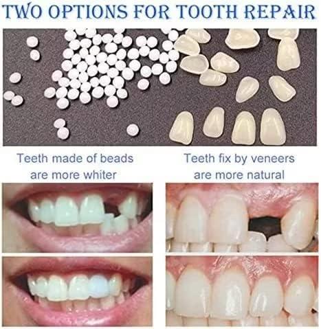 womcare Fake Tooth Repair Kits DIY Dental Care Kit Glue for Filling Missing Broken Teeth Crowns and Bridges Moldable Fake Teeth to Regain Your Beautiful Smile in Minutes-White Color