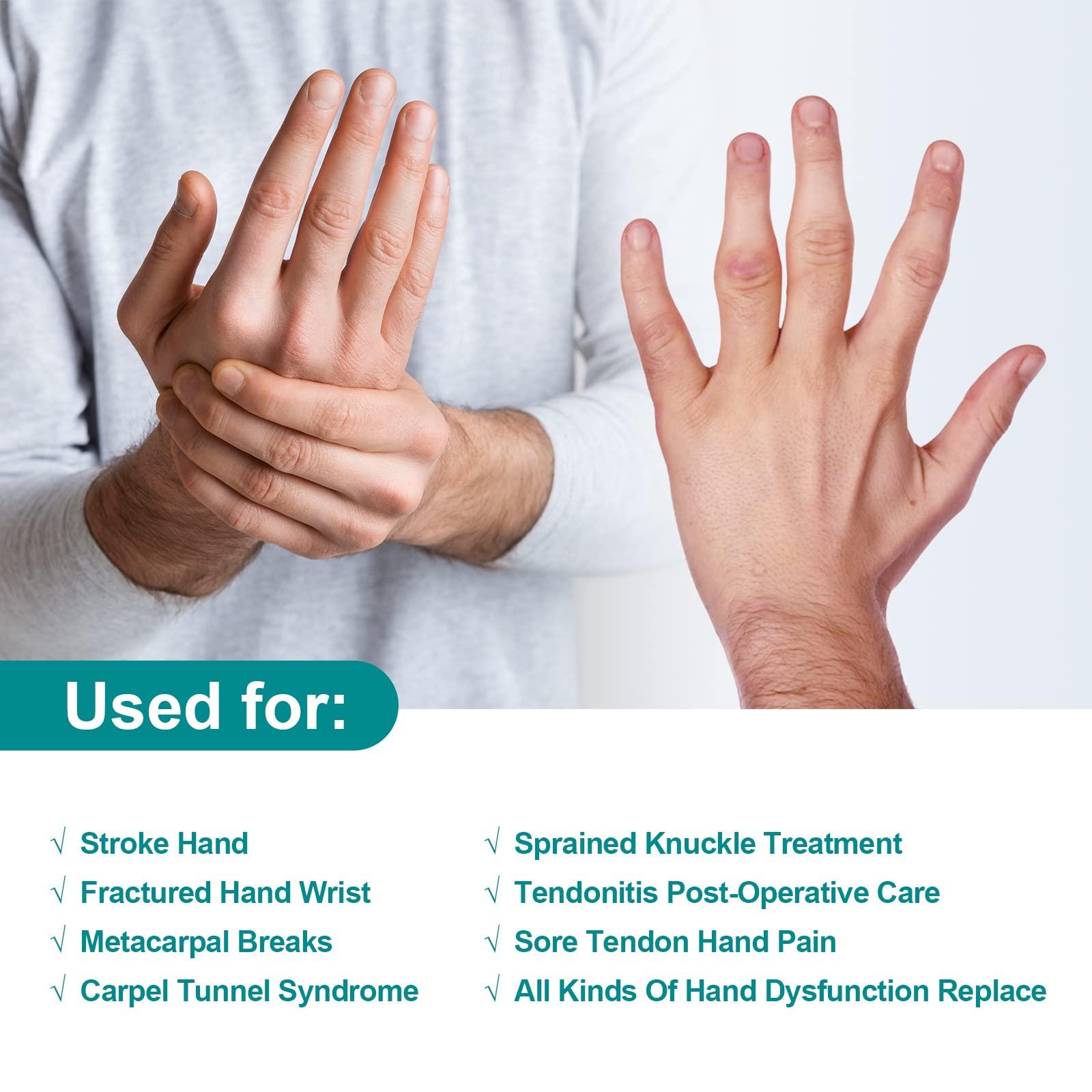 Sylong Sylong Stroke Resting Hand Splint Carpal Tunnel Wrist Brace Night Immobilizer, Finger Stabilizer Wrap - for Muscle Atrophy Rehabilitation, Arthritis, Tendonitis, Carpal Tunnel Pain