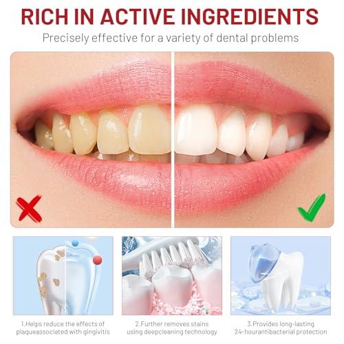 Mrryiio Sp10 Probiotic Toothpaste,Sp-10 Ultra Whitening Toothpaste,Probiotics Bright White Toothpaste,Sp-10 Probiotic Toothpaste,Sp10 Toothpaste,Fresh Breath,Deep Cleaning Care Toothpaste2Pcs