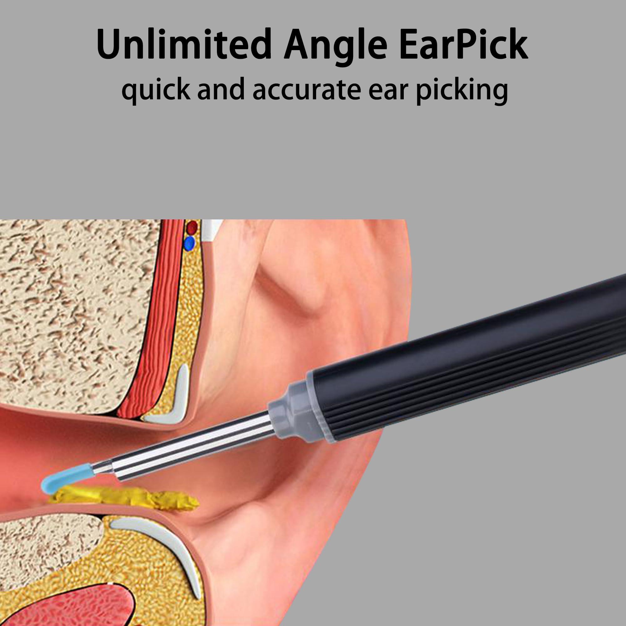 WILLFAN Ear Wax Removal with Camera, Ear Inspection System Wireless Earwax Removal Tool with Camera for Smart Devices