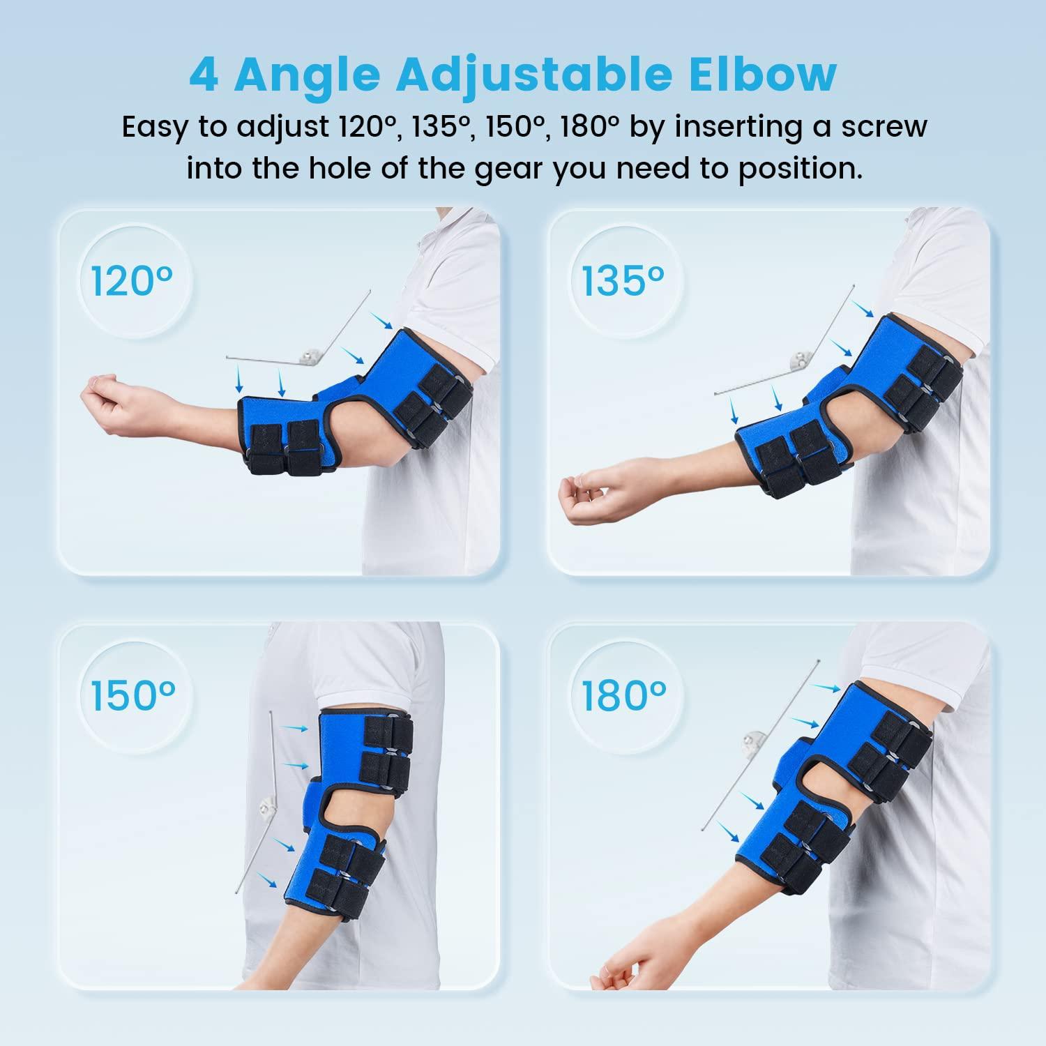 Sylong Elbow Splint, Elbow Brace for Cubital Tunnel Syndrome and Ulnar Nerve Entrapment,New Upgraded with 4 Angles Adjustable,Fixed Elbow,Prevent Excessive Bending,for Men,Women,fits Left and Right Arm -L/XL