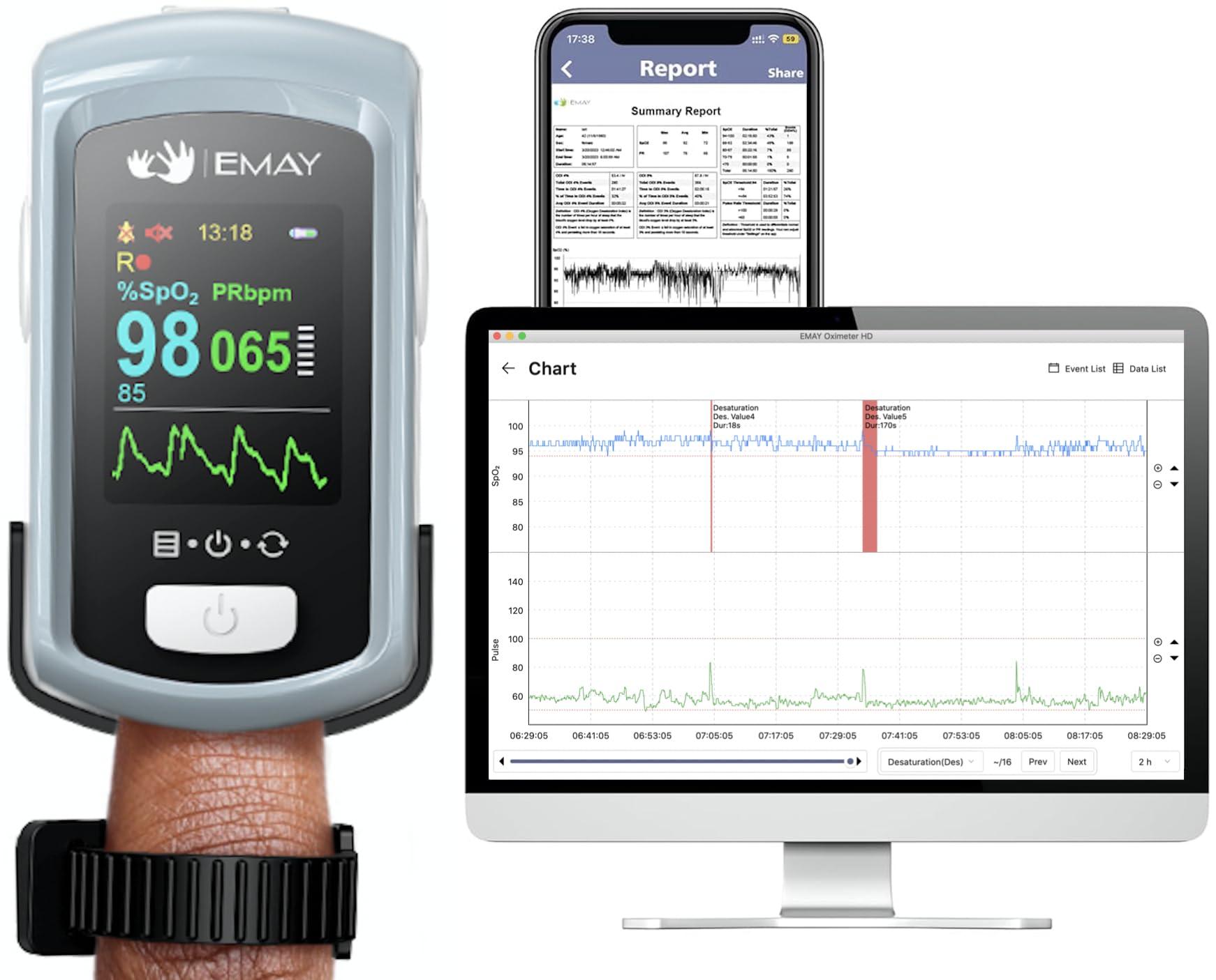 EMAY EMAY Sleep Oxygen Monitor with PC Software & App | Bluetooth Pulse Oximeter Rechargeable for Overnight & Continuous SpO2 Tracking with 72 Hours Built-in Memory | Gives Informative Report & Analysis