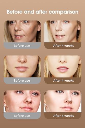 Aymeyly Ultra-Light Weight Red Light Therapy Mask, High Irradiance Red Light Therapy for Face, Comfortable Red Light Mask for Home Use