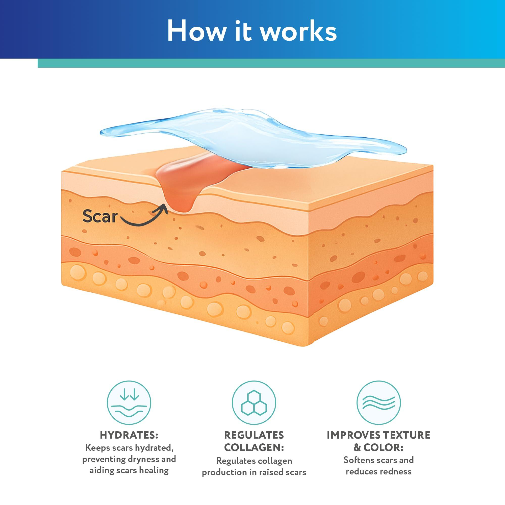 ScarAway ScarAway Silicone Scar Gel, Helps Improve Size, Color & Texture of Hypertrophic & Keloid Scars from Injury, Burns & Surgery, Water Resistant, 10g (0.35 Oz)