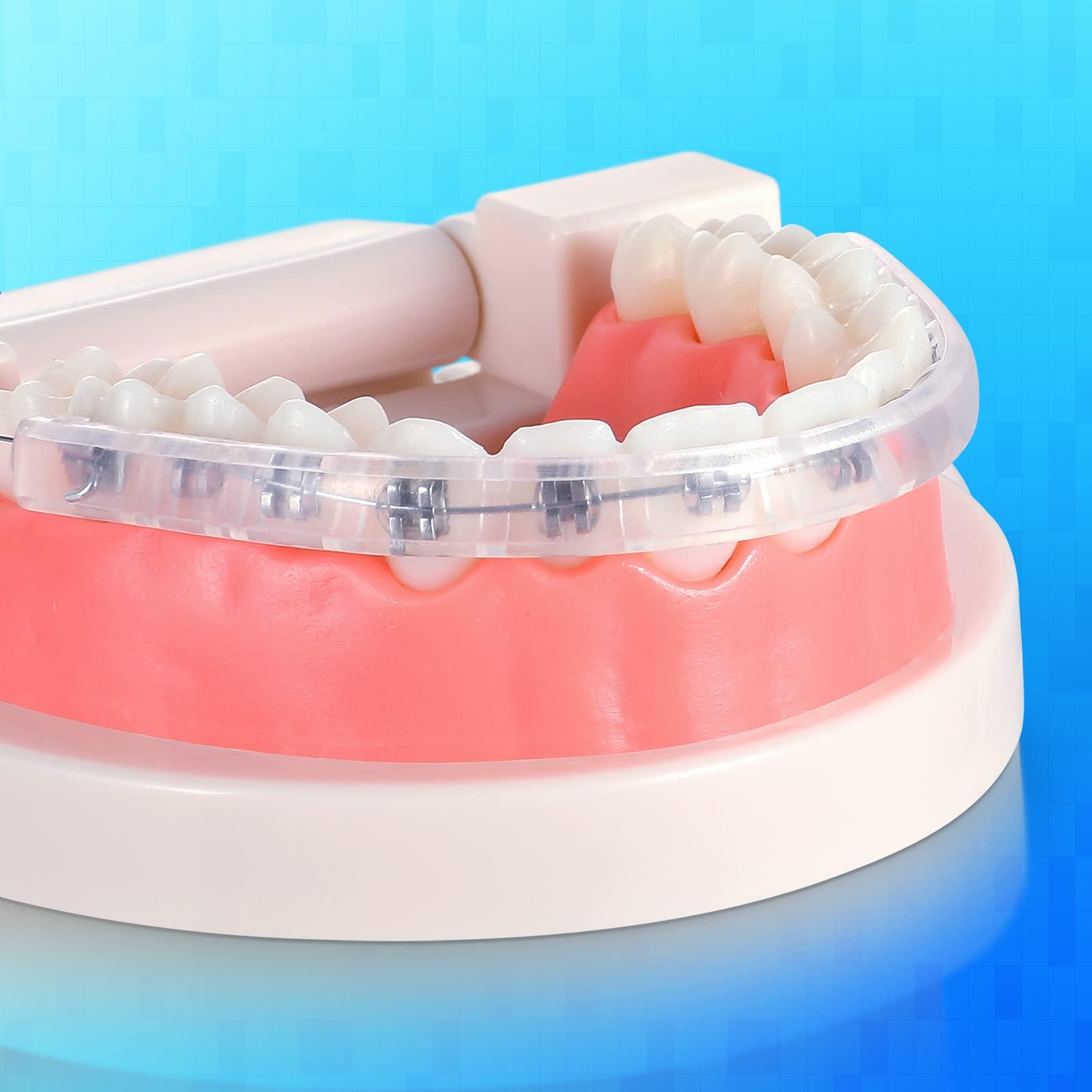 OBrush Obrush Comfort Covers for Braces - Orthodontic Mouth Guard, Lip Protector, Wax Alternative, Lip Shield for Brackets