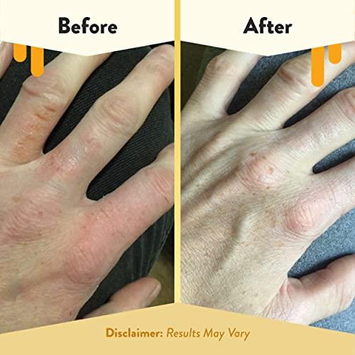ECZEMA HONEY ECZEMA HONEY Oatmeal Hand Cream - Natural Hand & Body Lotion for Eczema Rash Relief - Eczema Cream for Dry, Itchy, Sensitive, & Irritable Skin (4 Oz)