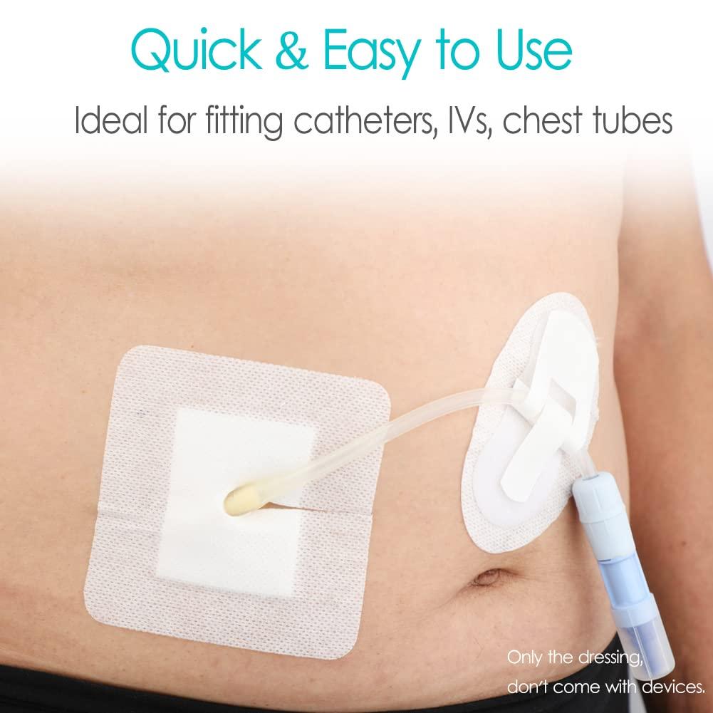 DiaBelt Peritoneal Dialysis PD Catheter Drain Split Bordered Gauze Island Dressing Pad for Stomach Feeding Peg J Tube| Individually Packed| Wound Bandage with Adhesive Border 4\" x 4\" (Pack of 10)