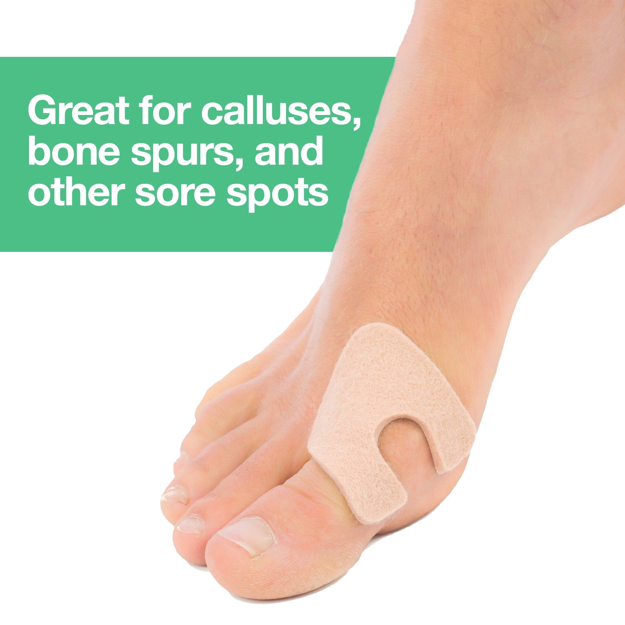 ZenToes ZenToes U-Shaped Felt Callus Pads | Protect Calluses from Rubbing on Shoes | Reduce Foot and Heel Pain | Pack of 24 1/8” Self-Stick Pedi Cushions