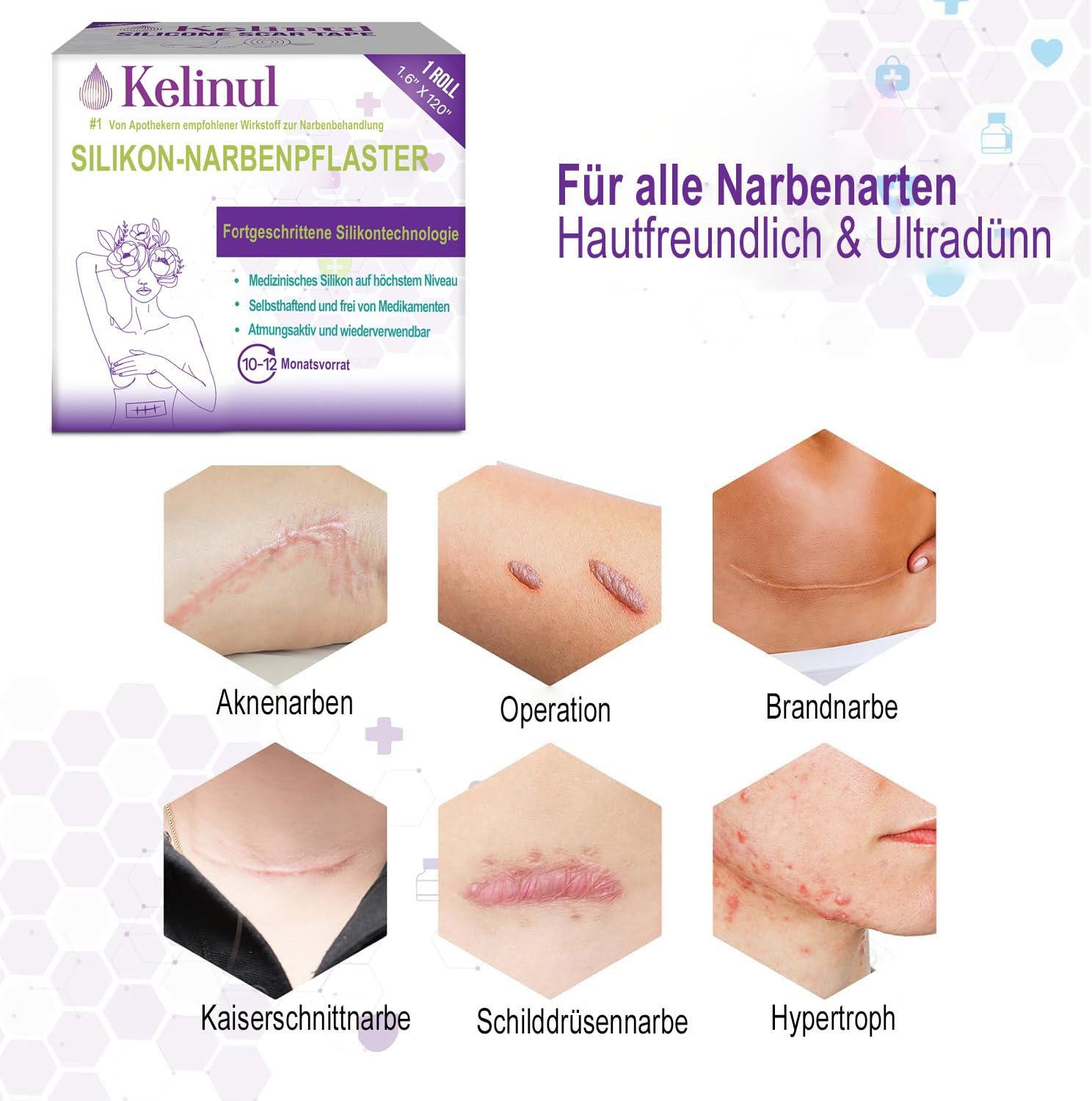 Kelinul Silicone Scar Sheets(1.6 x 120\"Roll-3M) Scar Removal Silicone Scar Tape for Softening and Flattening Scars, Acne, C-Section, Keloid Surgery, Painless Removal, Reusable, Washable, 10-12 Month Supply