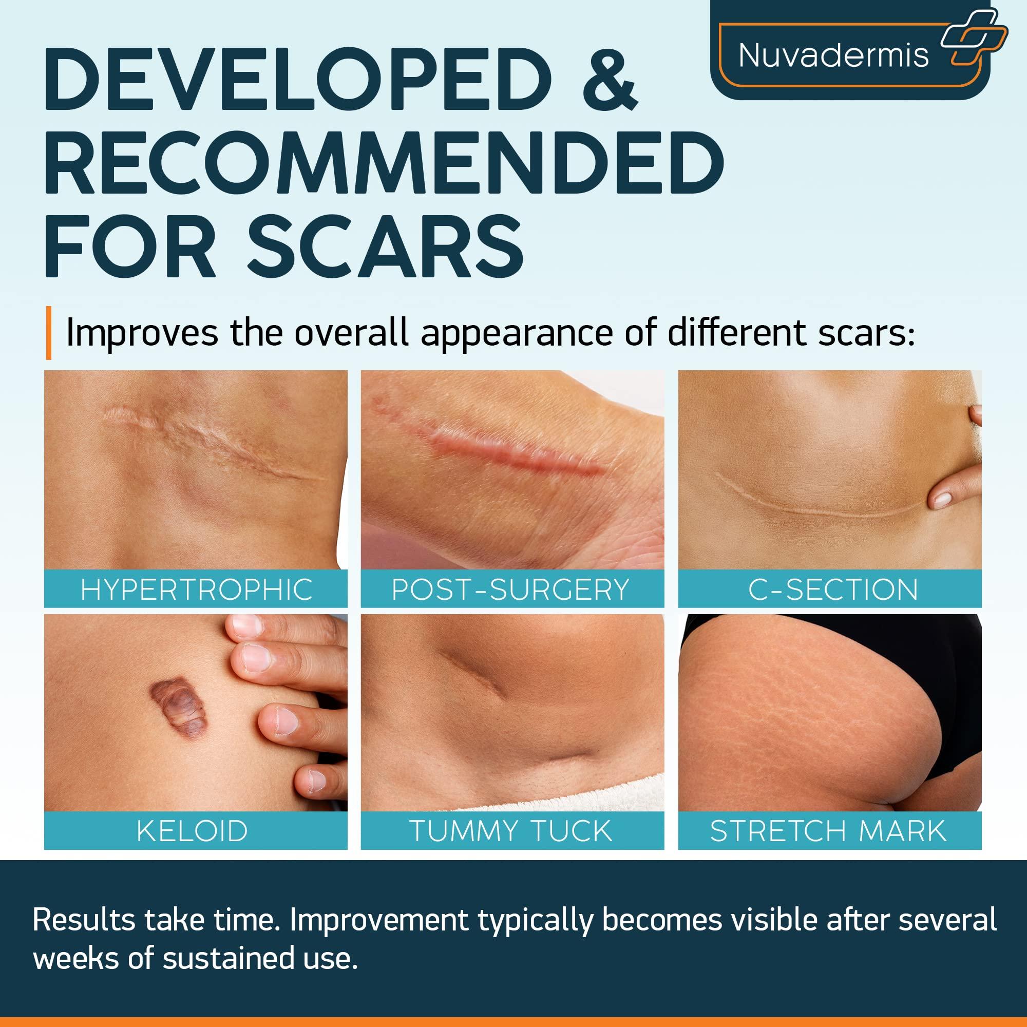 NUVADERMIS Nuvadermis Scar Care Bundle - Advanced Scar Gel 2 Pk & Silicone Scar Tape 1 Pk