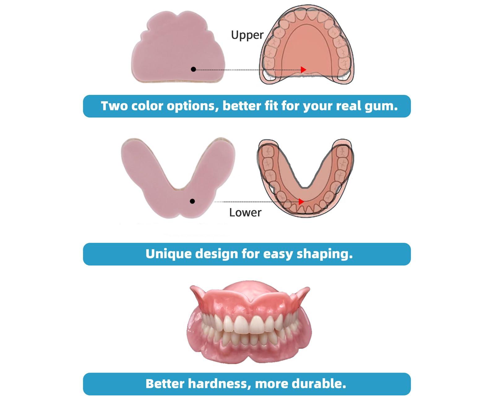 DENTUREWAY DENTUREWAY DIY Denture Kit with Impression(2 Sets of False Teeth),Do-It-Yourself Denture Solution,DIY Partial Denture kit, DIY Denture (Nature), Small