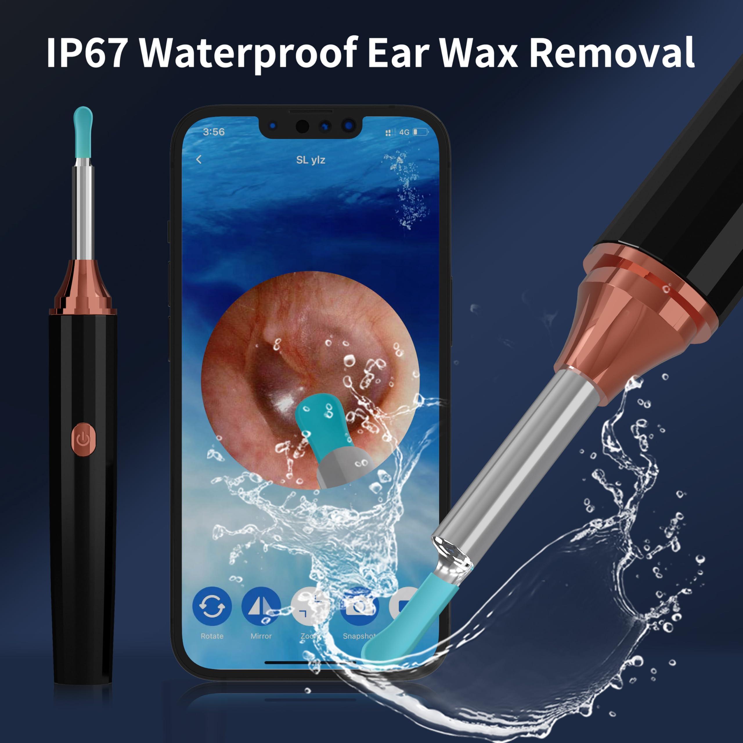 Docbraces Docbraces Ear Wax Removal,Ear Cleaner Tool with Ear Camera and Light,Earwax Removal kit with 4 Ear Pick,1080P Ear Camera Smart Visual Cleaning Kit for iOS&Android (Black)
