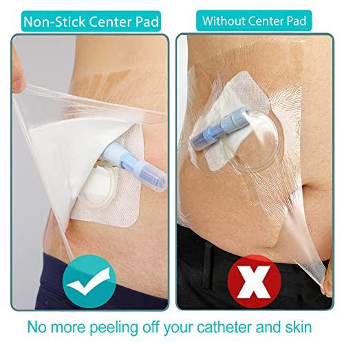 EaseToU EaseToU Waterproof Dialysis Catheter Shower Cover 8x8 - No Glue On The Center of The Patch, PD Peritoneal Dialysis Port Shower Protector Shield Island Bandage Dressing Patch Accessories (Pack of 25)