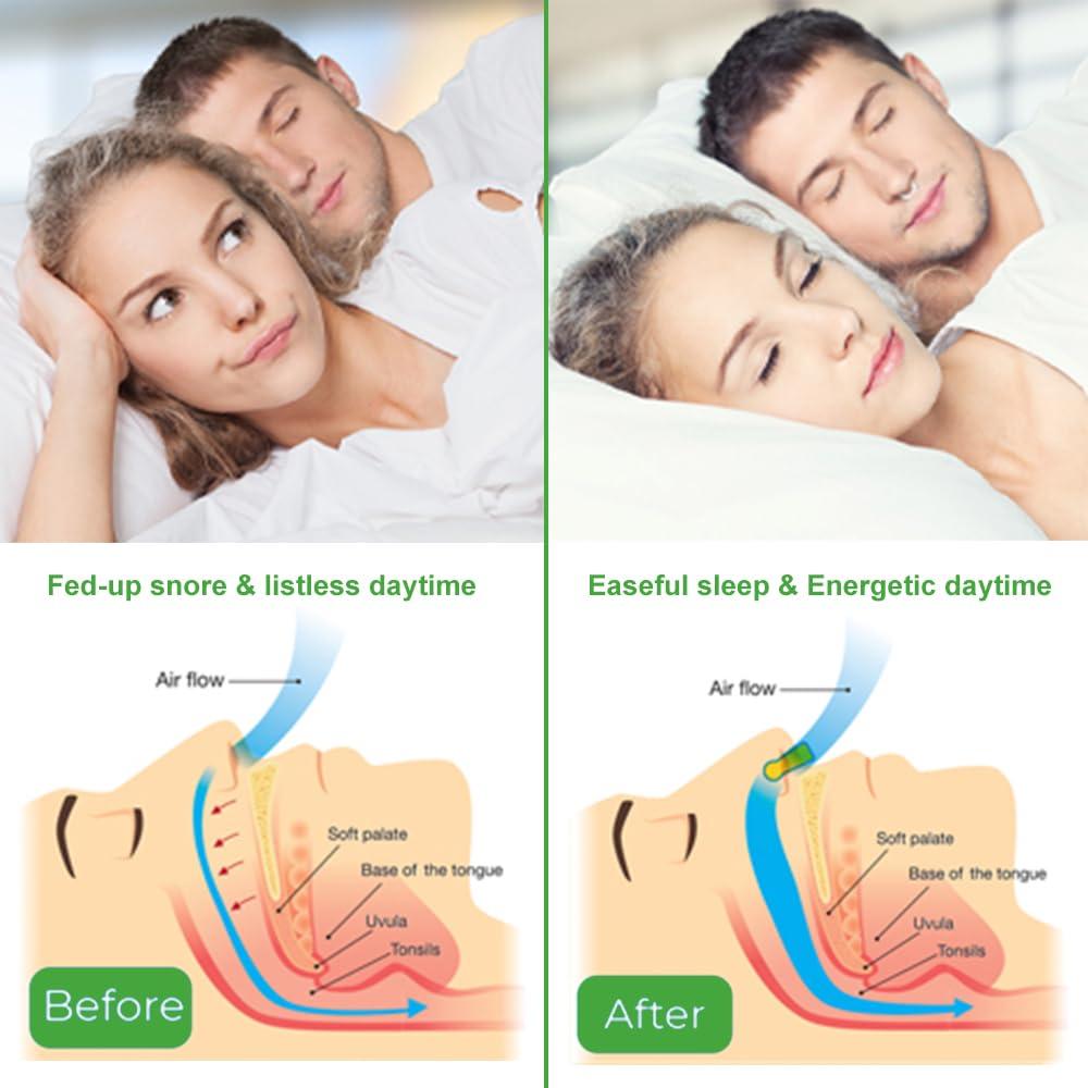 Generic Quiet Anti Snoring Devices, Comfortable Magnetic Snore Stopper, Anti Snoring Nose Clip, Effective Stop Snoring Device for a Better Sleep Apnea, Suitable for Man and Women, 4PCS