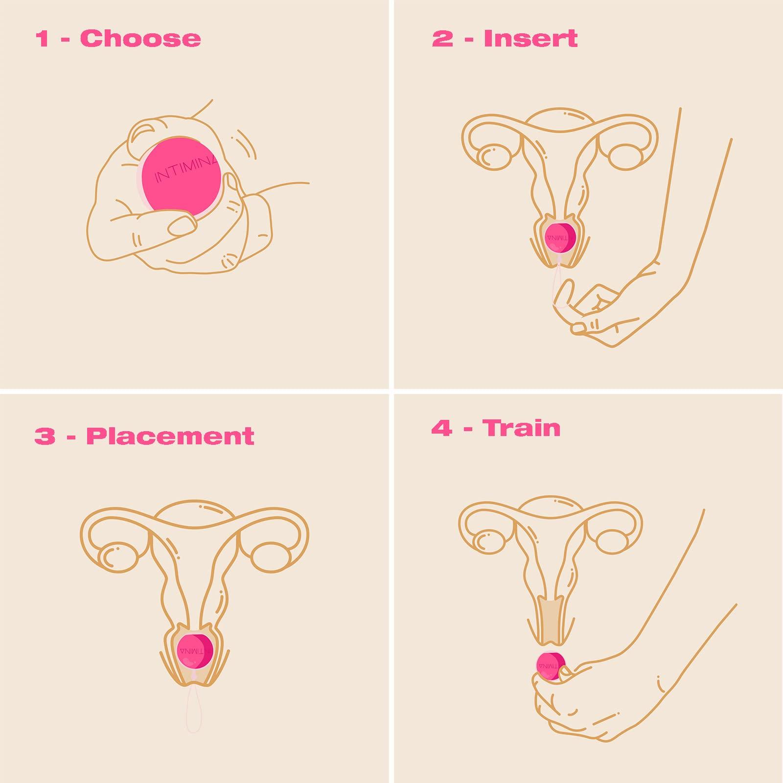 INTIMINA INTIMINA Laselle Weighted Exerciser Set - Womens 3 Pelvic Floor Weights (28g, 38g, 48g)