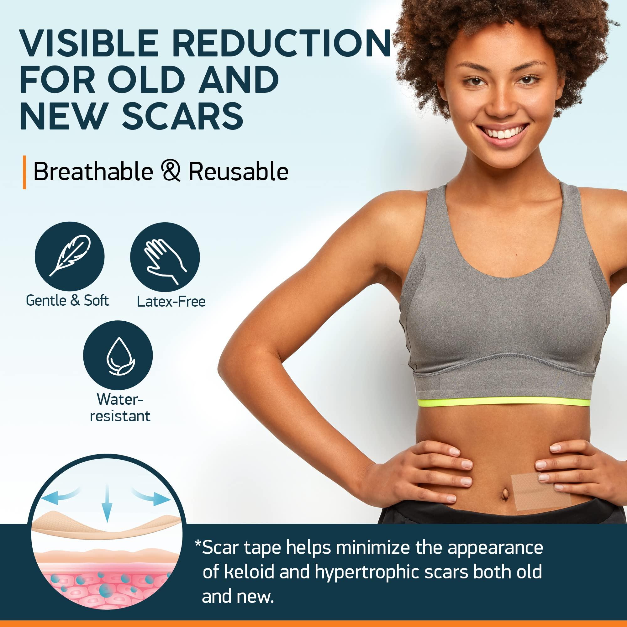 NUVADERMIS Nuvadermis Scar Care Bundle - Advanced Scar Gel 2 Pk & Silicone Scar Tape 1 Pk