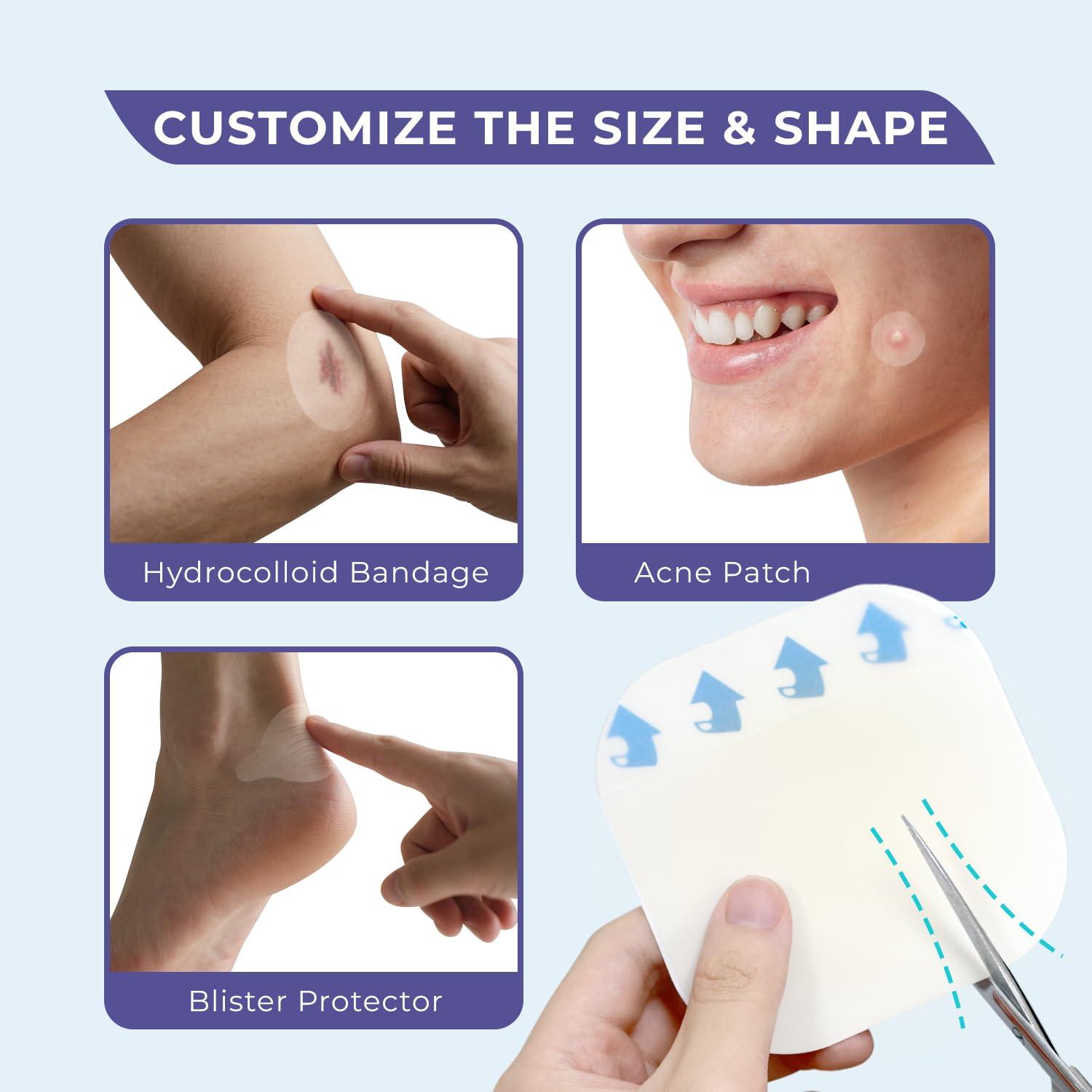 Conkote Conkote Hydrocolloid Wound Dressing 4”x 4”, Sterile Adhesive Patches, Box of 10 Dressings