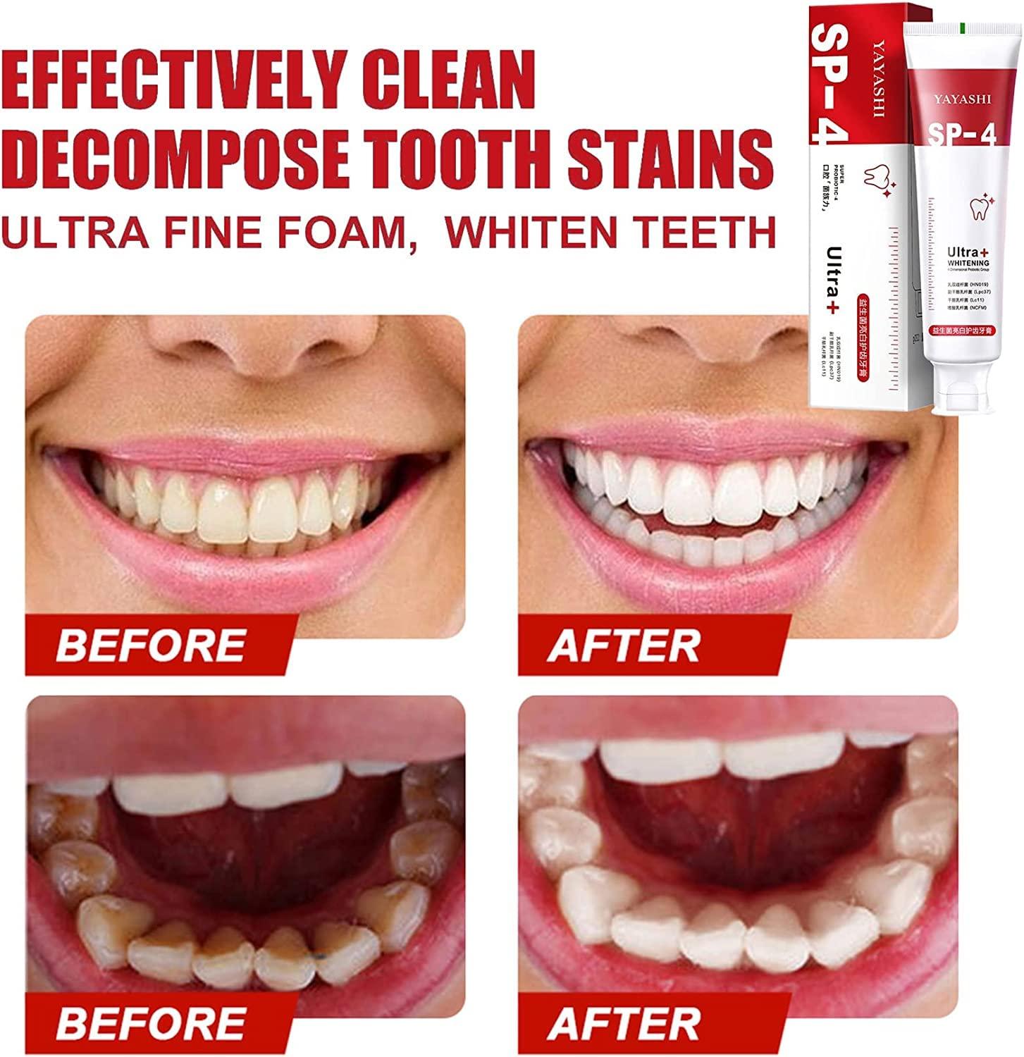 Generic SP-4 Probiotic Stain Removal and Whitening Toothpaste - Ultra+, SP-4 Ultra Whitening Toothpaste, Yayashi SP-4 Probiotic Whitening Toothpaste, Pasta De Dientes SP-4 (1PCS Deodorize)
