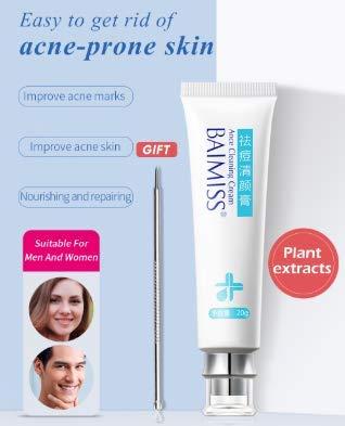 Tink knub BAIMISS Herbal Acne Treatment Cream 1PCS Remove Acne Scar Pimple Face Cream Skin Care Acne Send Removal Needle