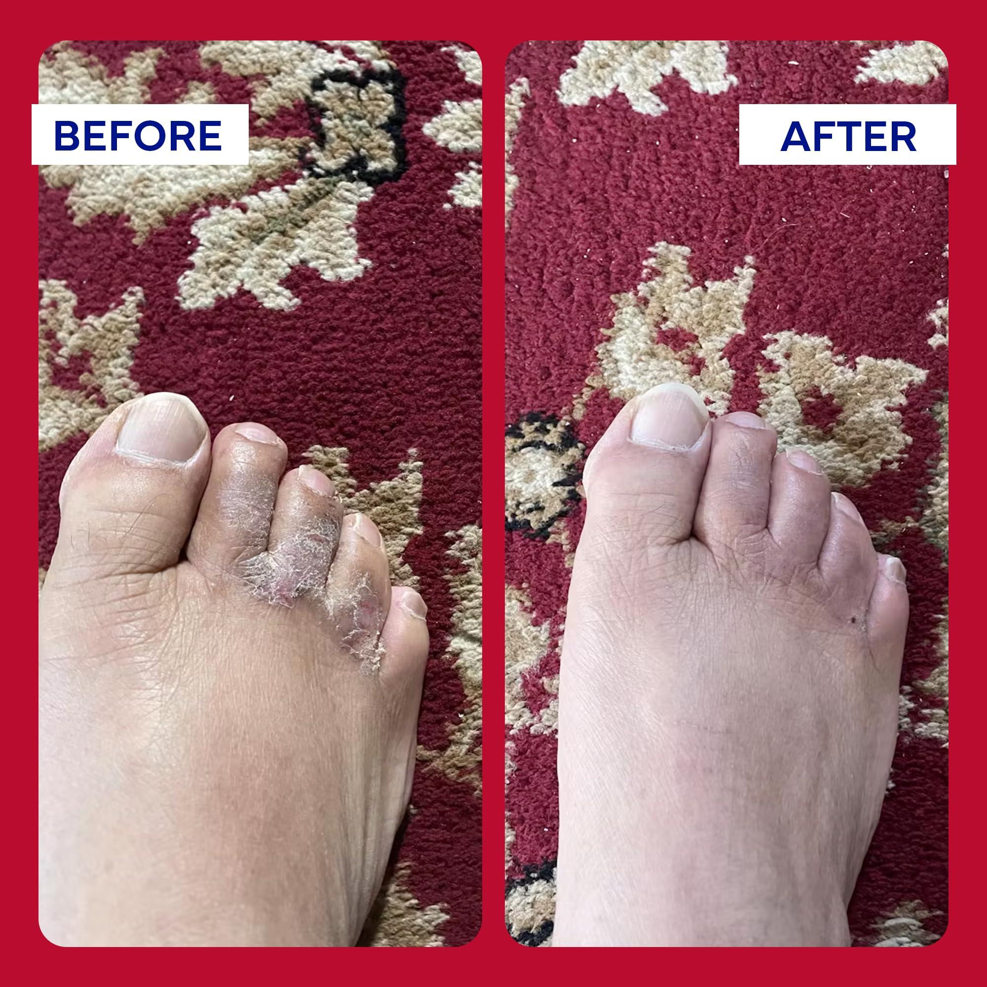 emuaid EMUAIDMAX First Aid Homeopathic Ointment, Natural Fast-Acting Topical Ointment for Resistant Skin Conditions, Reduces Itching, Pain, and Swelling, On-The-Go Travel Size, 0.35oz, 2 Pack