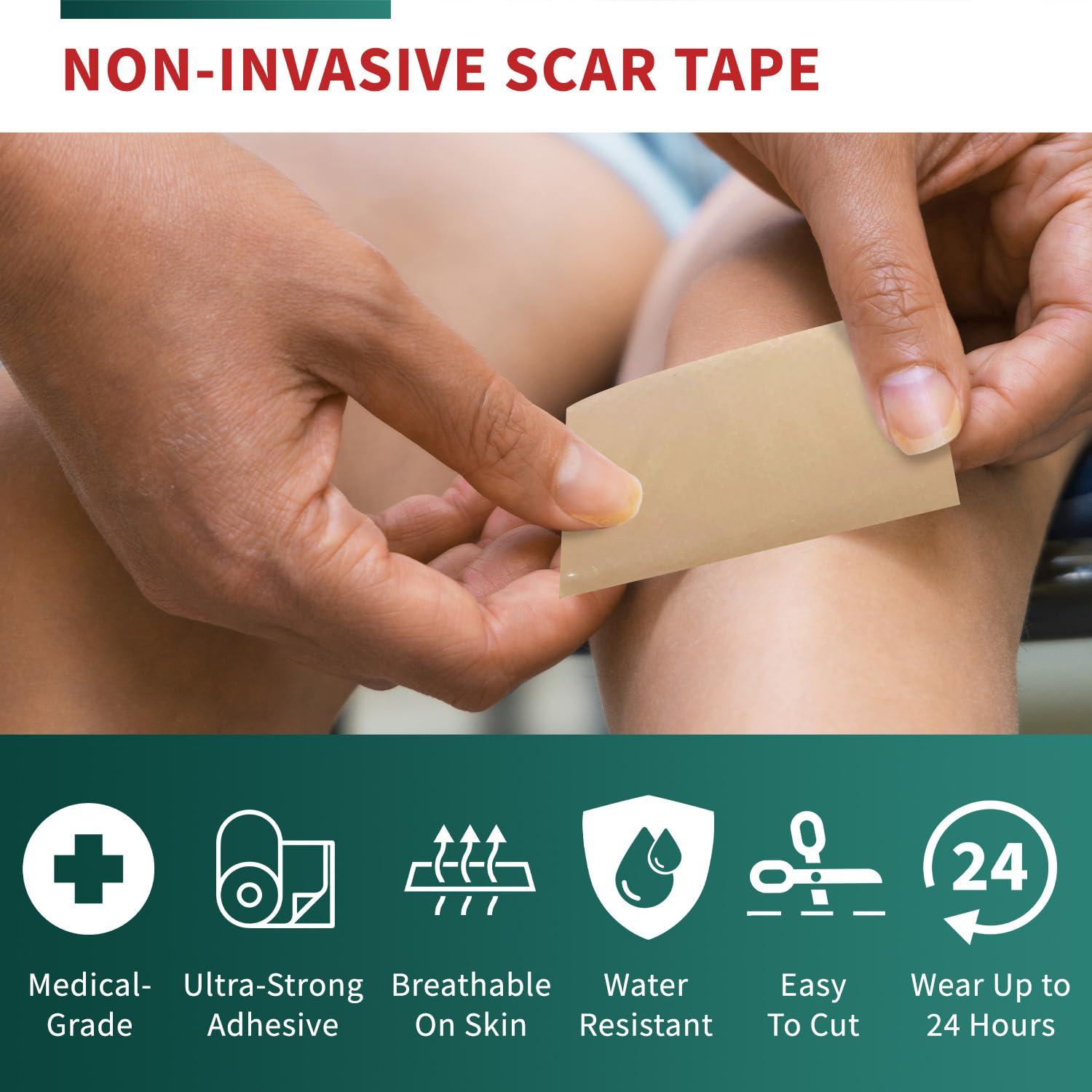 Protect Life Medical Grade Silicone Scar Tape Advanced Adhesive Formulation (1.6" x 118") Scar Removal Away Strips for Surgical Scars, Silicone Tape & Keloid Scar Treatment, Reusable Silicone Scar Sheets