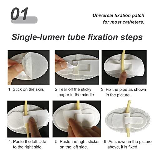 Chihutown 4 Pack Catheter Stabilization Device Tape, Catheter Tube Holder Adhesive, Foley Catheter Fixing Sticker, Catheter Securement Adhesive