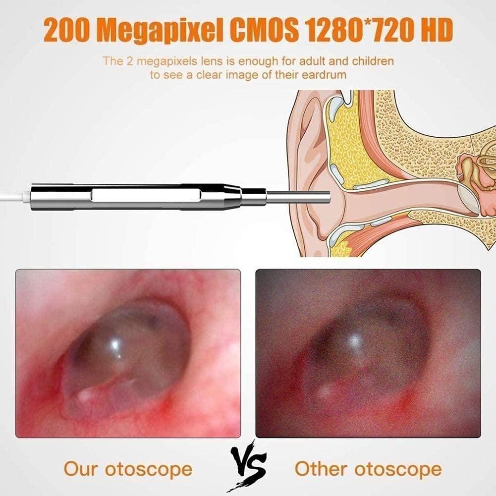 QIYUDS QIYUDS Ear Wax Removal Endoscope,Ear Wax Removal Camera with 4.3\" IPS Screen, 1280x1080 FHD Smart Visual Ear Cleaner with Camera Tool Kit, Plug & Play at Home Ear Infection Detector Ear Wax Remover Ot