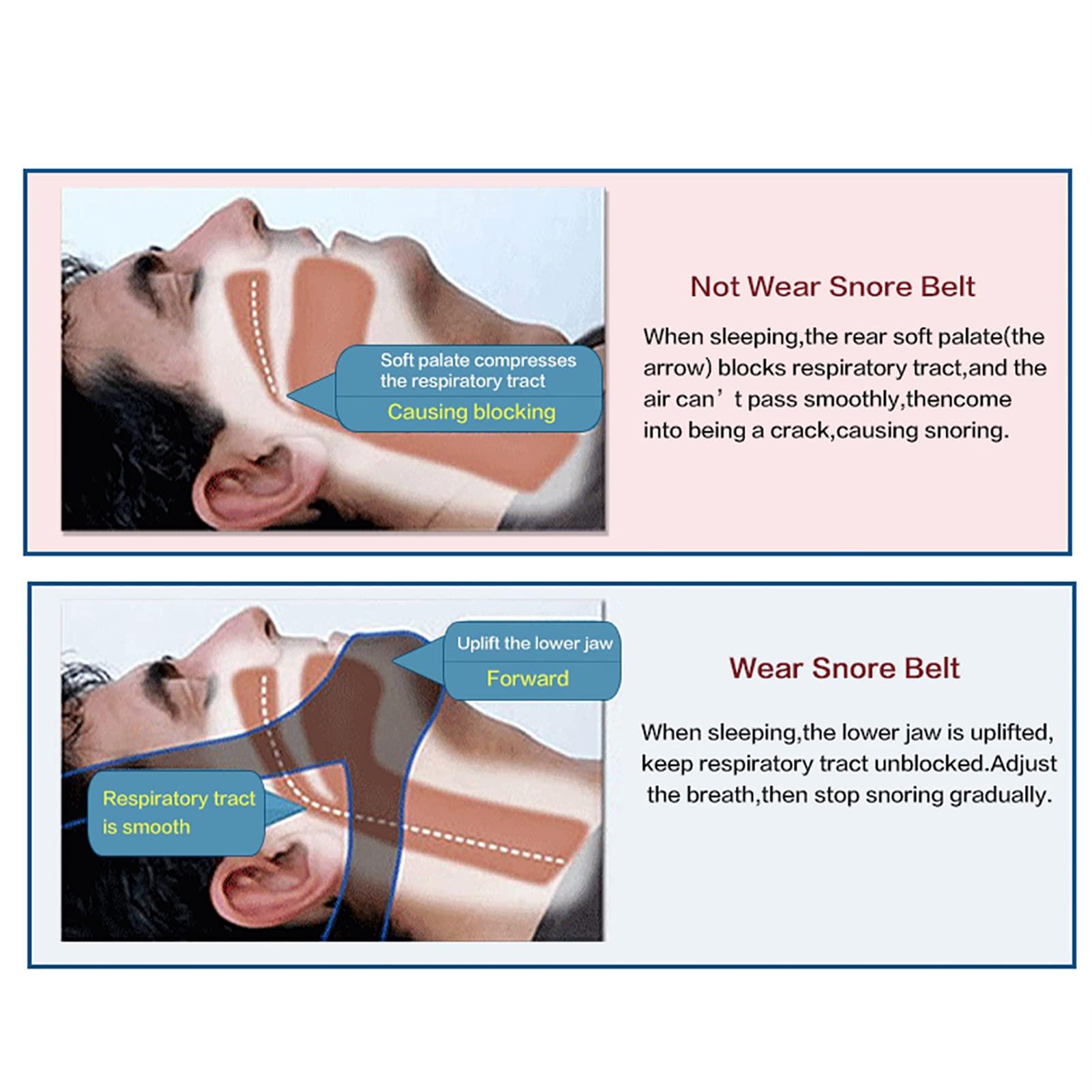 Mrisata Cpap Chin Strap 1382 Chin Strap Anti Snore Belt Apnea Jaw Support Solution Sleep