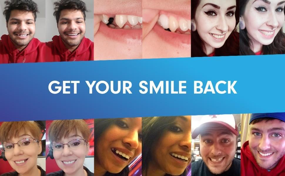 Temptooth Temptooth #1 Seller Trusted Patented Temporary Tooth Replacement Product