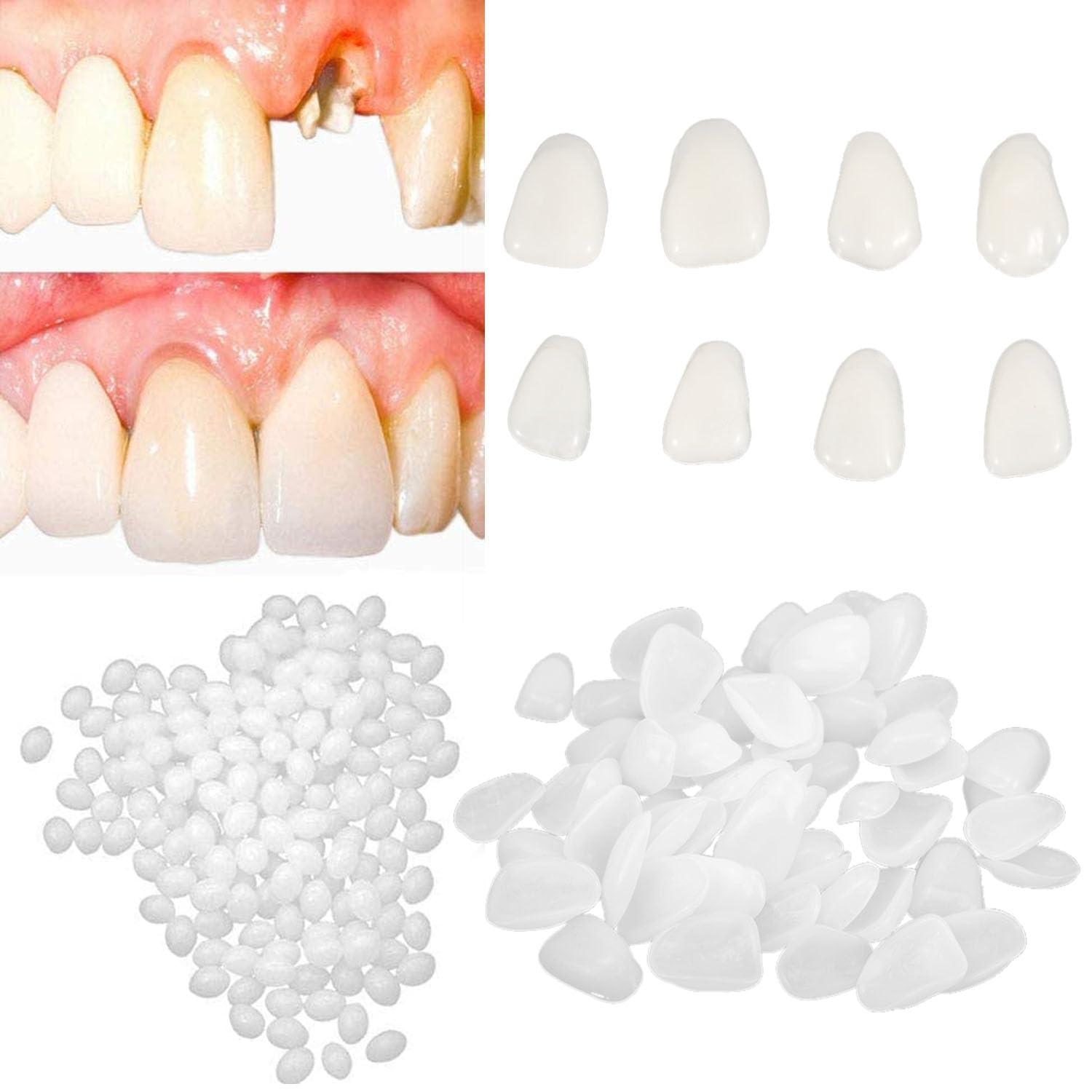womcare Fake Tooth Repair Kits DIY Dental Care Kit Glue for Filling Missing Broken Teeth Crowns and Bridges Moldable Fake Teeth to Regain Your Beautiful Smile in Minutes-White Color