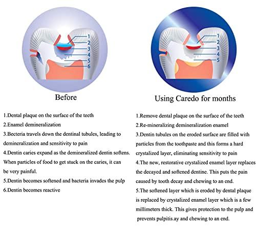 CAREDO Kids Hydroxyapatite Toothpaste for Reversing Cavities, Fluoride-Free Home Cavity Repair, Safe Toddler & Baby Toothpaste for Enamel Repair, Tooth Decay Repair Remineralizing Treatment Fruity 1Tube