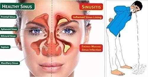 The Yogis The Yogis 304 Grade Stainless Steel Ayurvedic Jal Neti Pot for Sinus Congestion and Nasal Cleansing Steel Jal Neti Pot for Nasal Wash | Size: 500mL | With - 1 Rubber Neti and 1 Eye Wash Cup