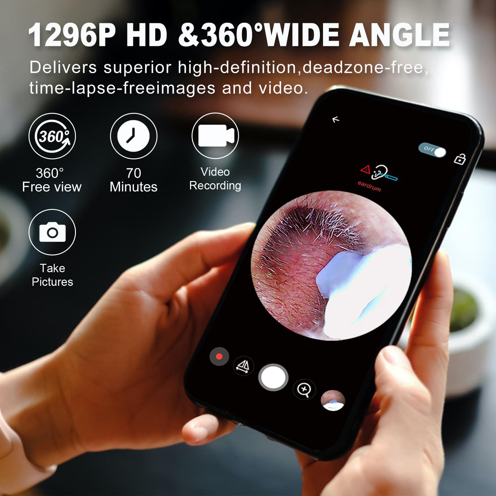 Right Ear Wax Removal, Ear Cleaner with Camera and Light, Ear Wax Removal Kit with 1296P Otoscope, Ear Cleaning Tool with 6 Ear Spoon, Ear Camera for iPhone & Android Phones,Black