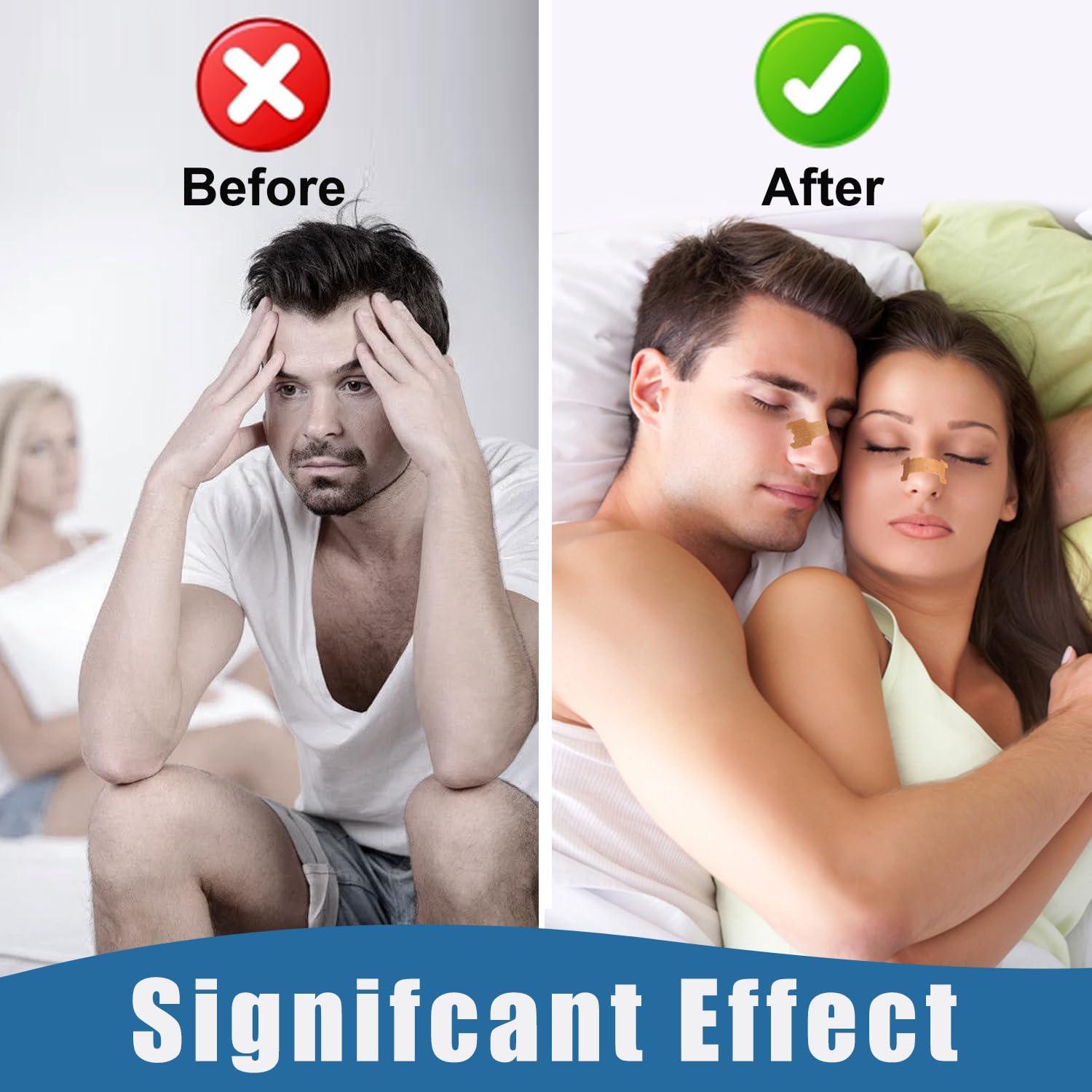 tyelason Tyelason Nasal Strips - 120 Count Nasal Strips for Snoring, Extra Strength Tan Nasal Breathing Strips to Improve Sleep, Instant Nasal Congestion Relief Caused by Colds & Allergies