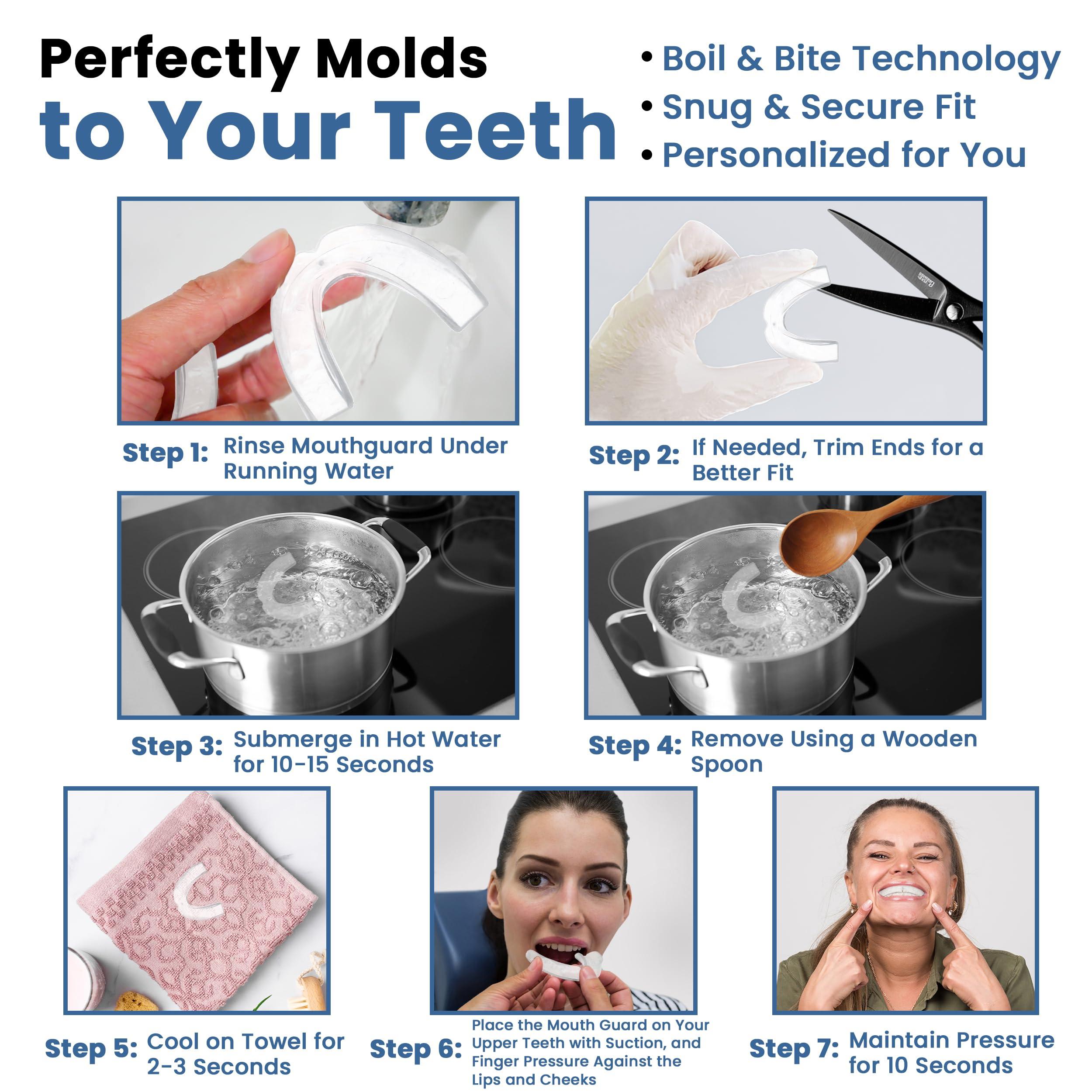 ProDental Professional Mouth Guard for Grinding Teeth - 6 Customizable Dental Guards - 2 Sizes, USA Made, BPA Free | Eliminate Bruxism, Teeth Clenching | Also for Sports & Teeth Whitening